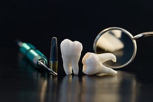 Real Human Wisdom teeth, titanium implant and Dental instruments