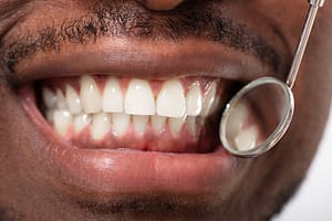 Gum Disease is preventable