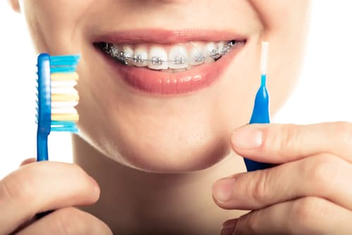 interdental brushes for braces